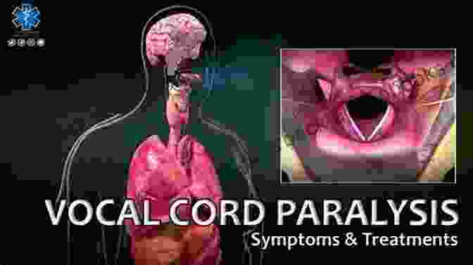 Book Cover Of Vocal Fold Paralysis Jeri Westerson