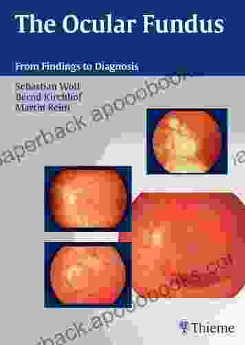 Ocular Fundus: From Findings To Diagnosis